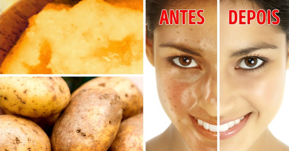 8 Alimentos do dia a dia que escondem propriedades cosméticas