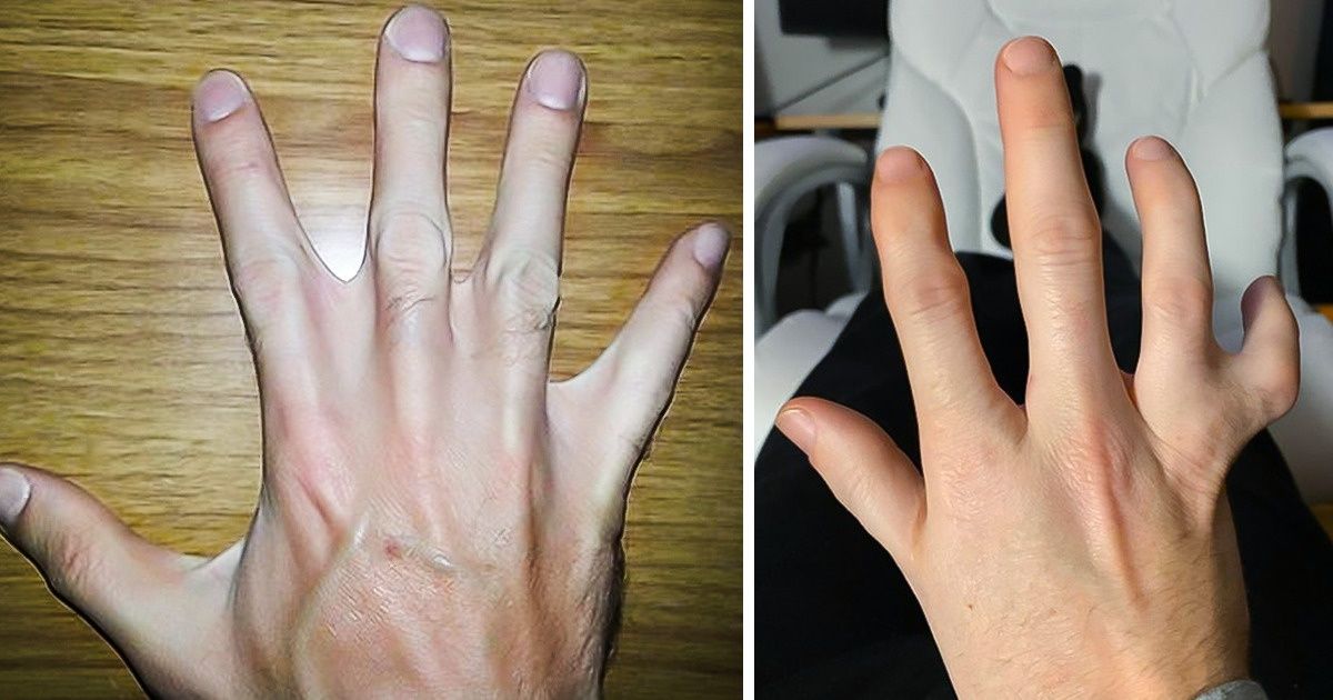 16 Pessoas que foram abençoadas pela natureza e ganharam detalhes únicos 16 Pessoas que foram abençoadas pela natureza e ganharam detalhes únicos