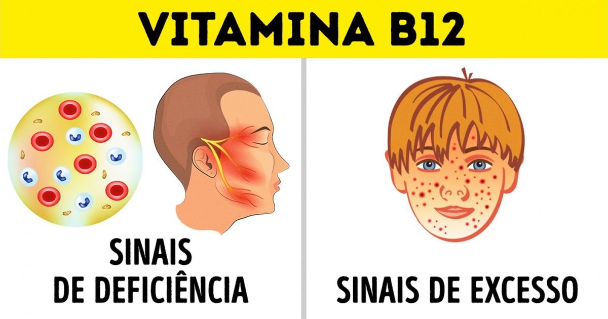 6 Informações interessantes sobre as vitaminas 6 Informações interessantes sobre as vitaminas