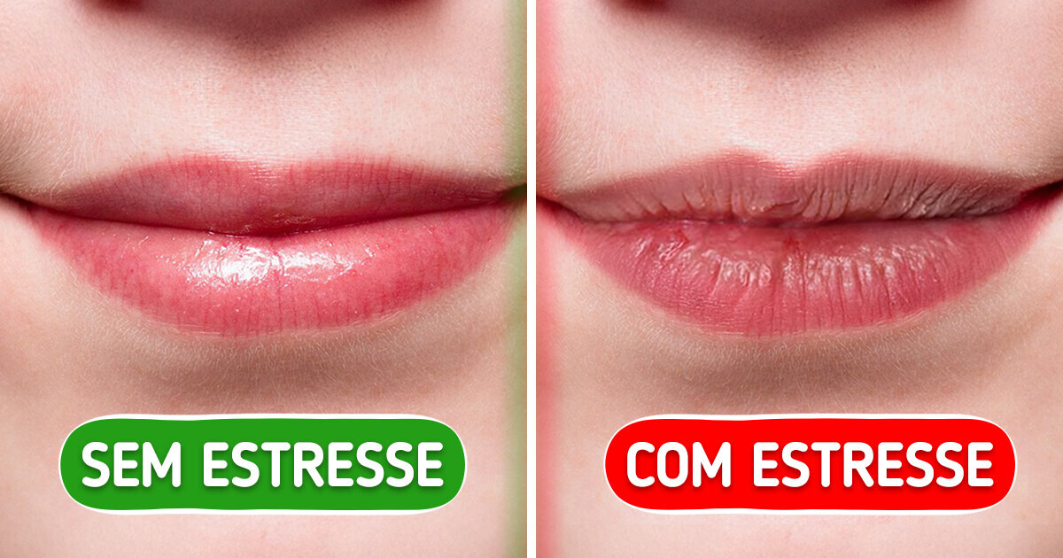 7 Indícios de que o estresse tomou conta do seu corpo 7 Indícios de que o estresse tomou conta do seu corpo
