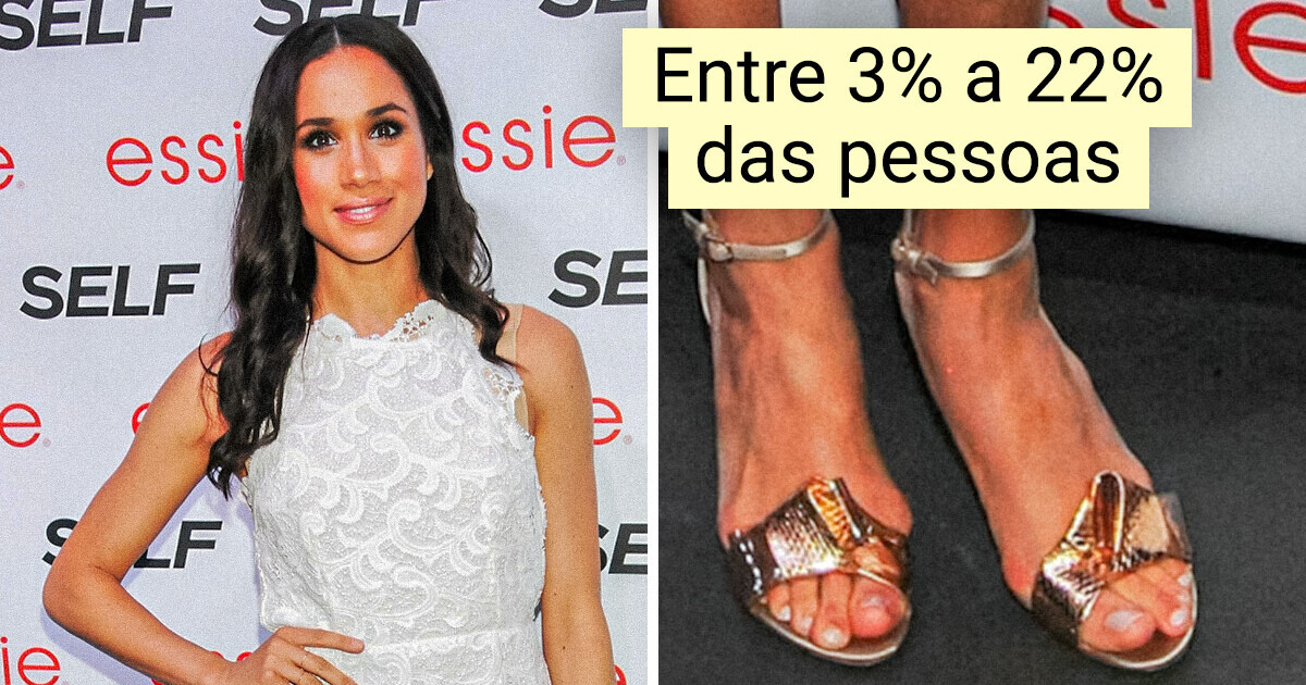 10+ Detalhes do corpo tão raros que vão te fazer sentir edição limitada