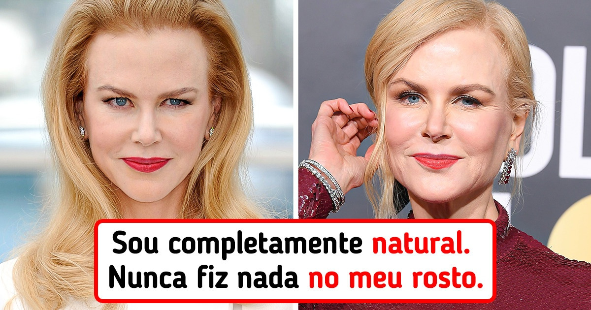 8 Celebridades belíssimas que decidiram abrir mão de procedimentos estéticos