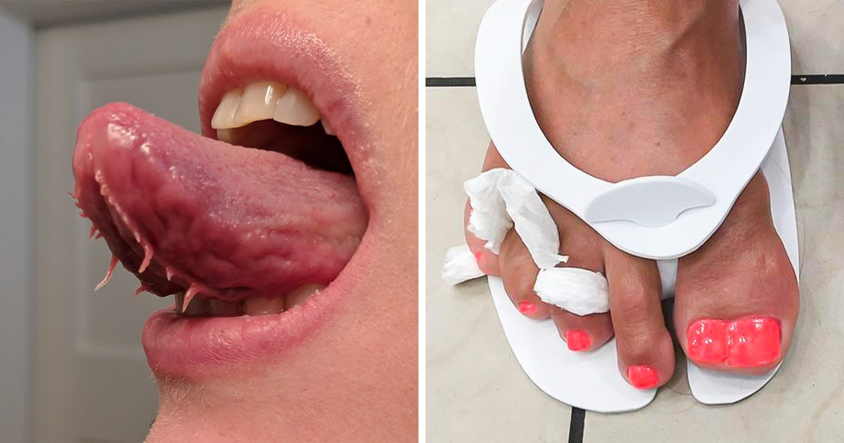19 Pessoas que transformaram o que chamavam de defeito em charme único