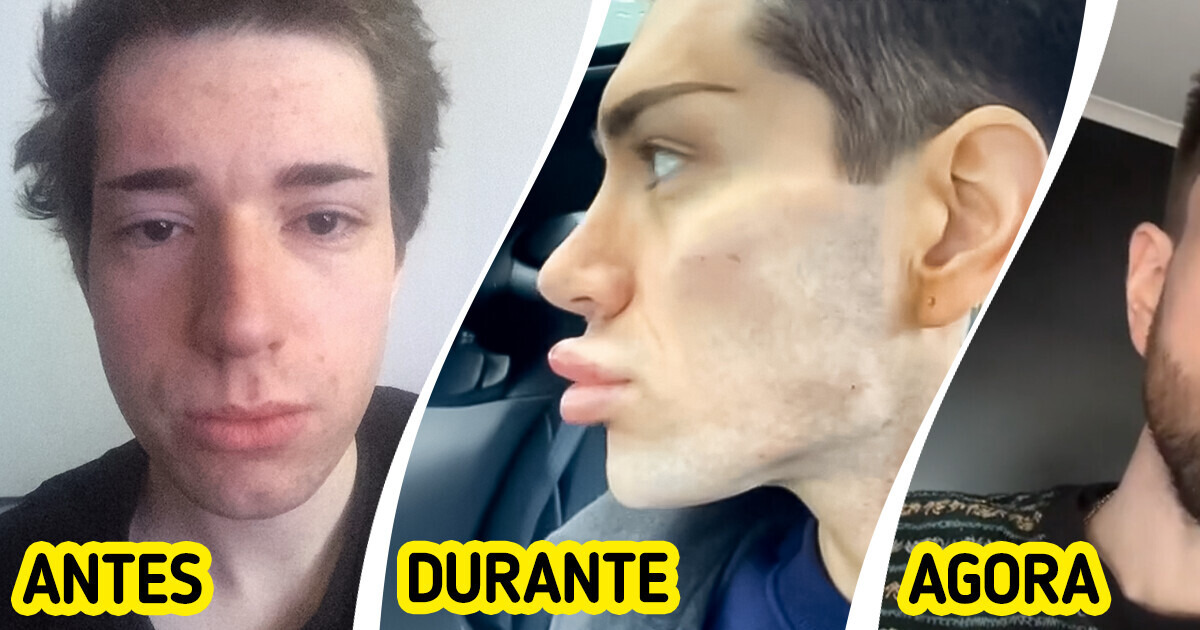 Homem passa por transformação facial extrema e se torna fenômeno na Internet Homem passa por transformação facial extrema e se torna fenômeno na Internet