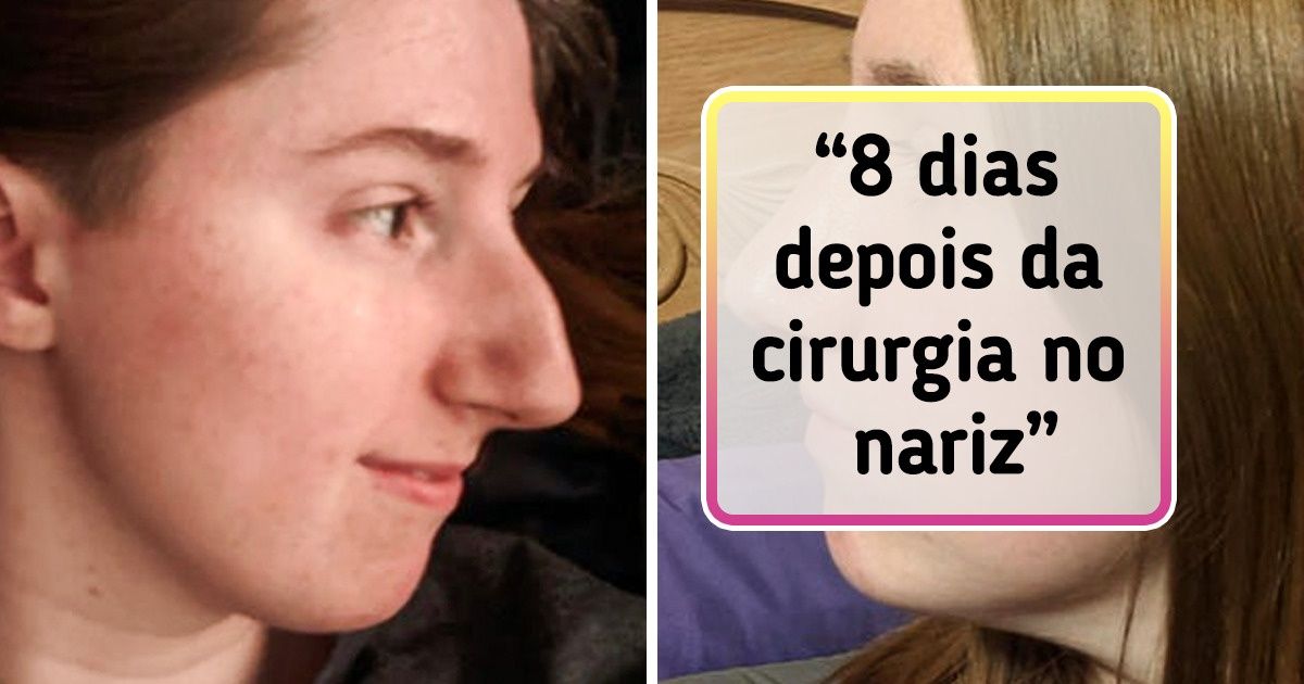 20 Fotos de “antes e depois” que mostram o progresso na sua forma mais pura (nova seleção)