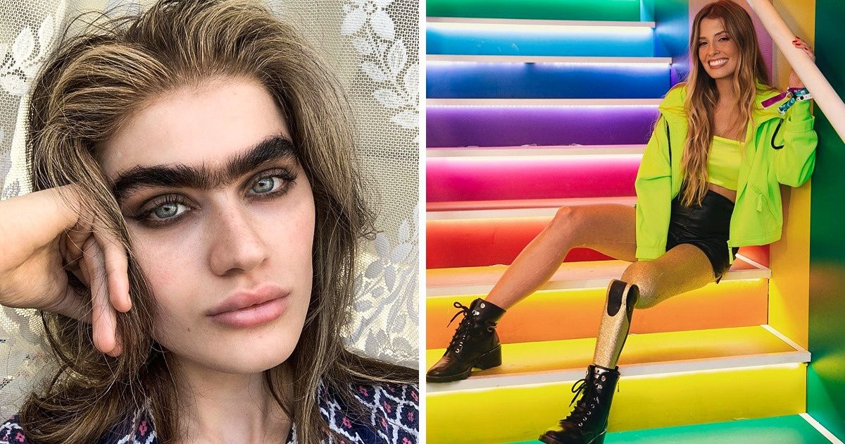 Modelos que dão uma lição de vida e mostram que a beleza está justamente nas diferenças