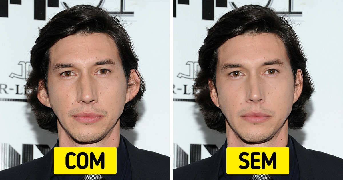 Como 11 celebridades seriam sem seus traços físicos mais marcantes