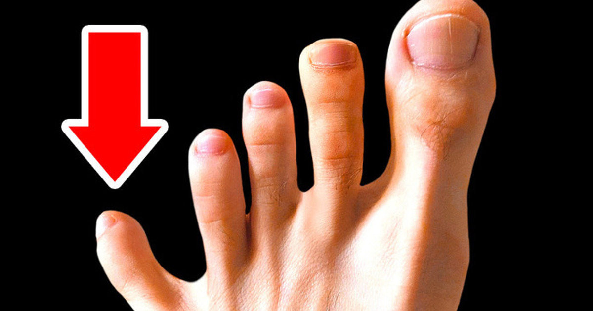 Você não precisa de 5 dedos do pé, nem de outras 14 funções do seu corpo