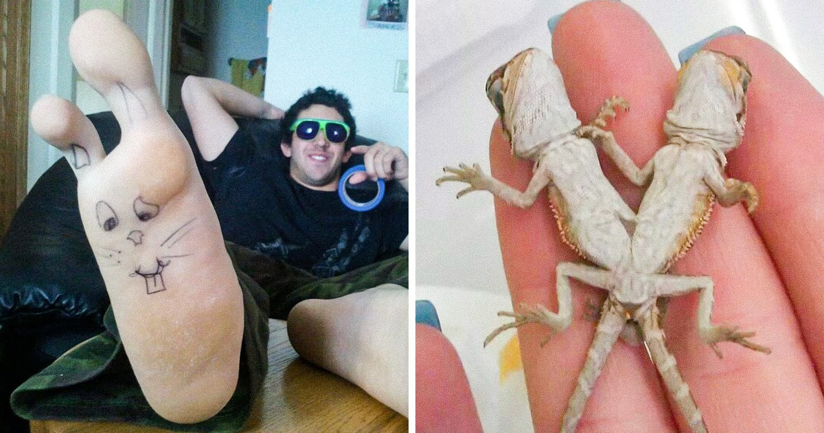 14 Fotos que representam a verdadeira beleza de ser único 14 Fotos que representam a verdadeira beleza de ser único