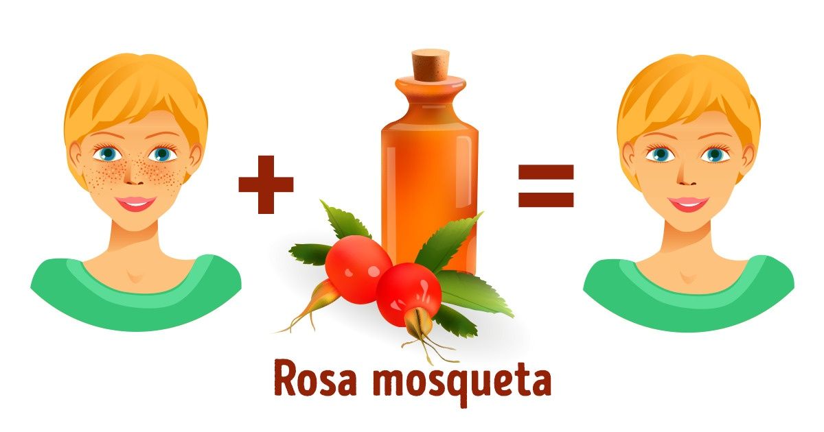 Benefícios da rosa mosqueta para a pele e o cabelo Benefícios da rosa mosqueta para a pele e o cabelo
