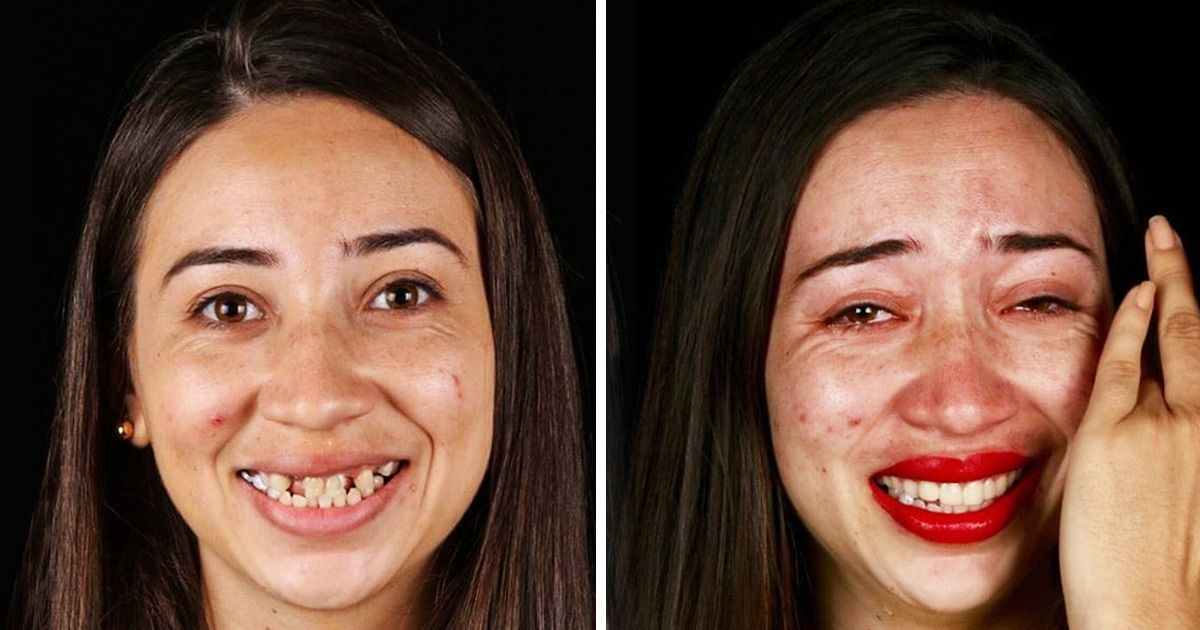 Com trabalho em equipe, dentista brasileiro resgata o sorriso de pessoas de baixa renda Com trabalho em equipe, dentista brasileiro resgata o sorriso de pessoas de baixa renda