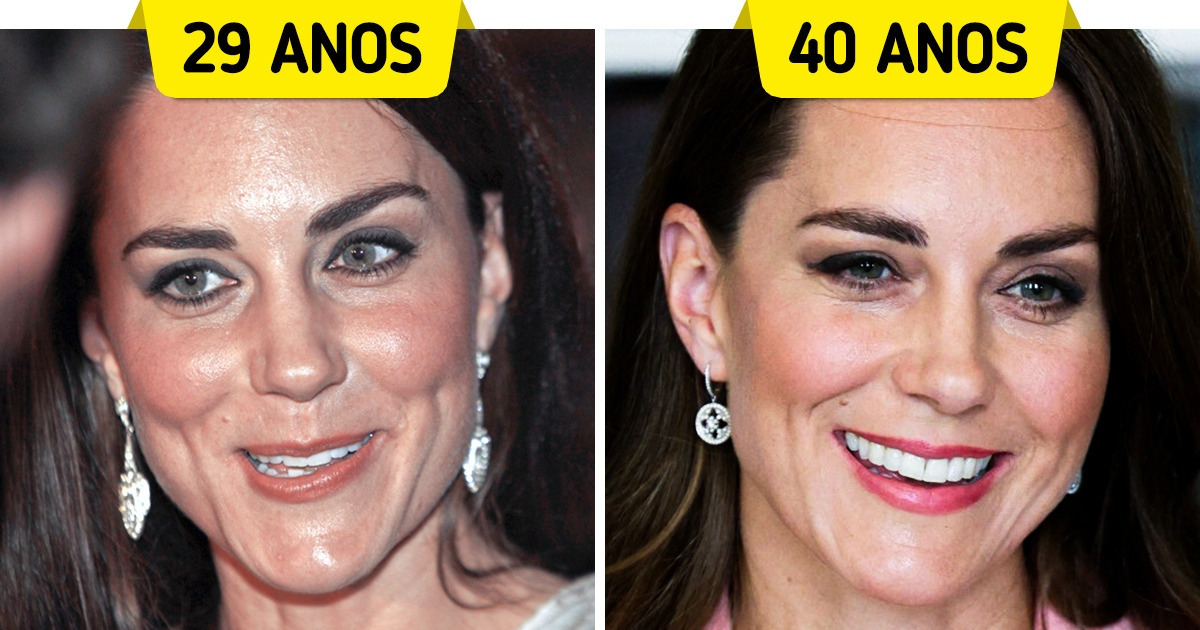 17 Fotos que mostram como os membros da realeza mudaram ao longo do tempo