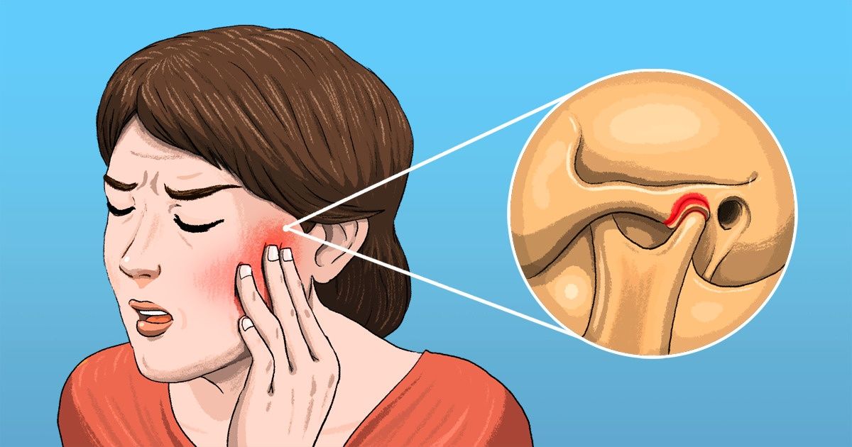 5 Dores que você pode confundir com dor de dente, mas que têm outra origem