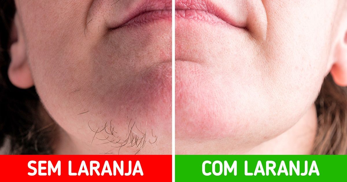 9 Ingredientes simples para se livrar dos pelos faciais sem sair de casa