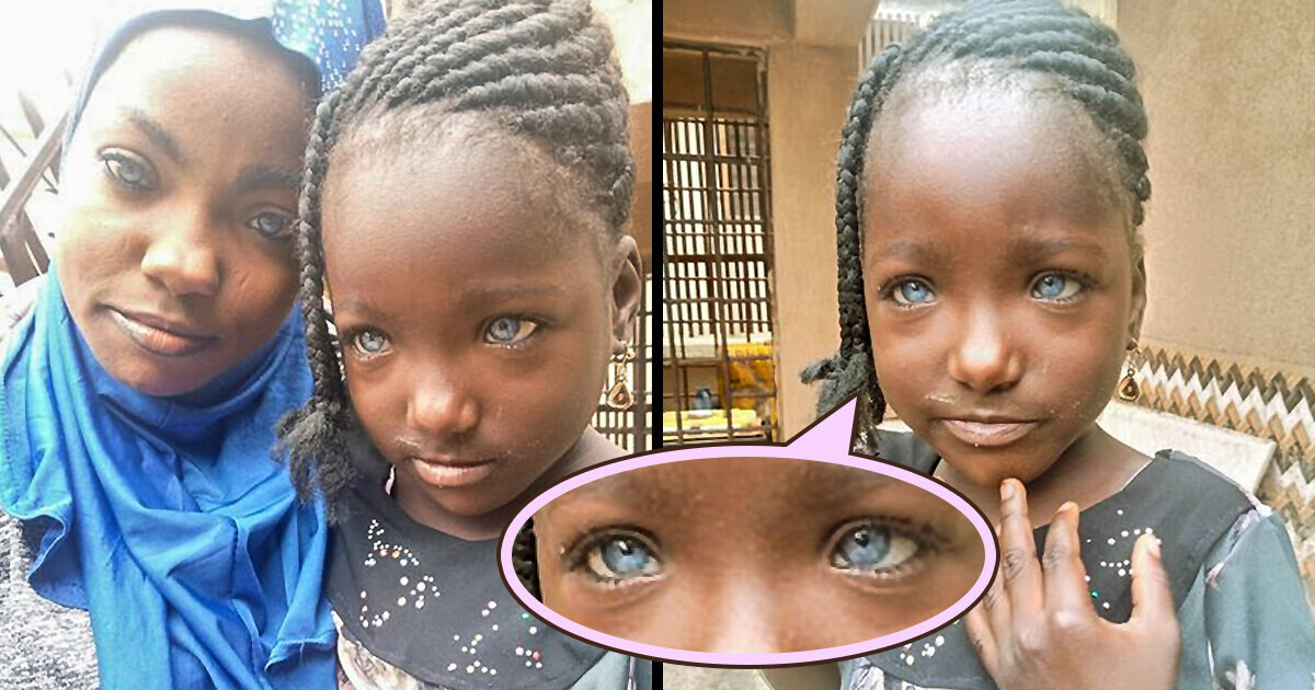A beleza incompreendida: A família que sofreu uma grande perda apenas pela cor de seus olhos