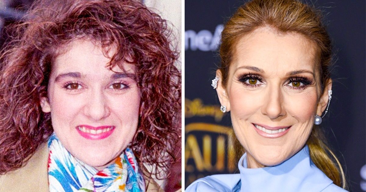 10 Famosos que superaram uma infância complicada