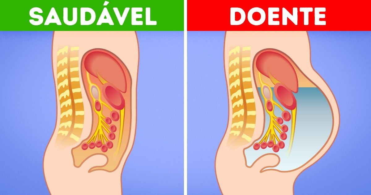 8 Sintomas de doenças hepáticas que precisam de avaliação médica 8 Sintomas de doenças hepáticas que precisam de avaliação médica