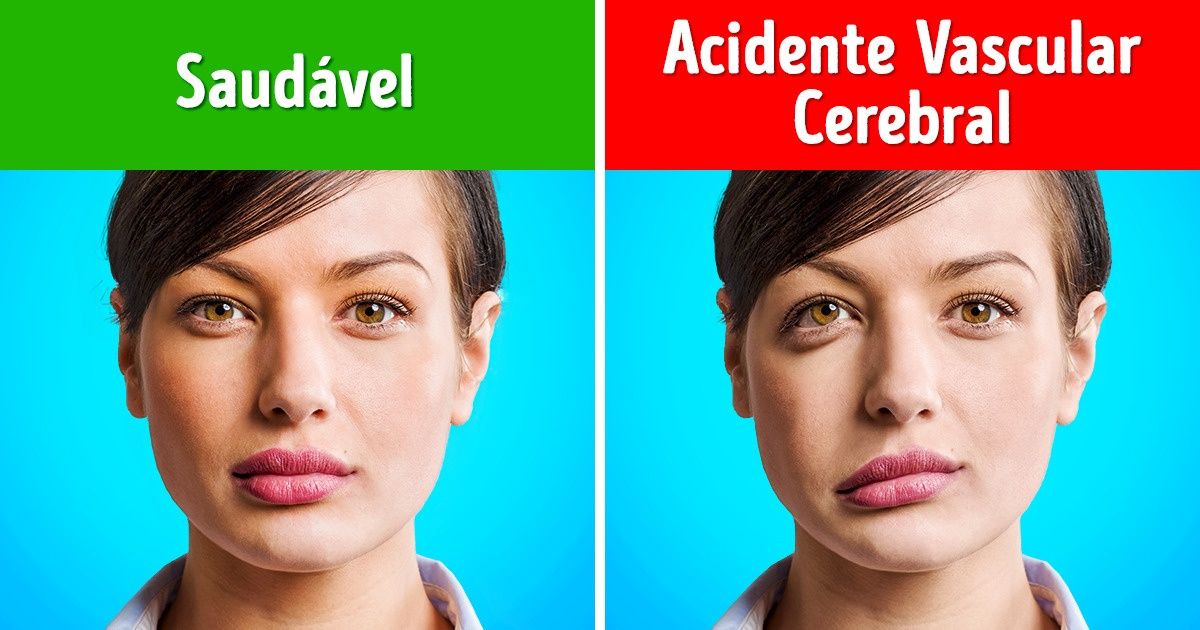 Conhecer a diferença entre essas 3 doenças do coração pode salvar sua vida Conhecer a diferença entre essas 3 doenças do coração pode salvar sua vida
