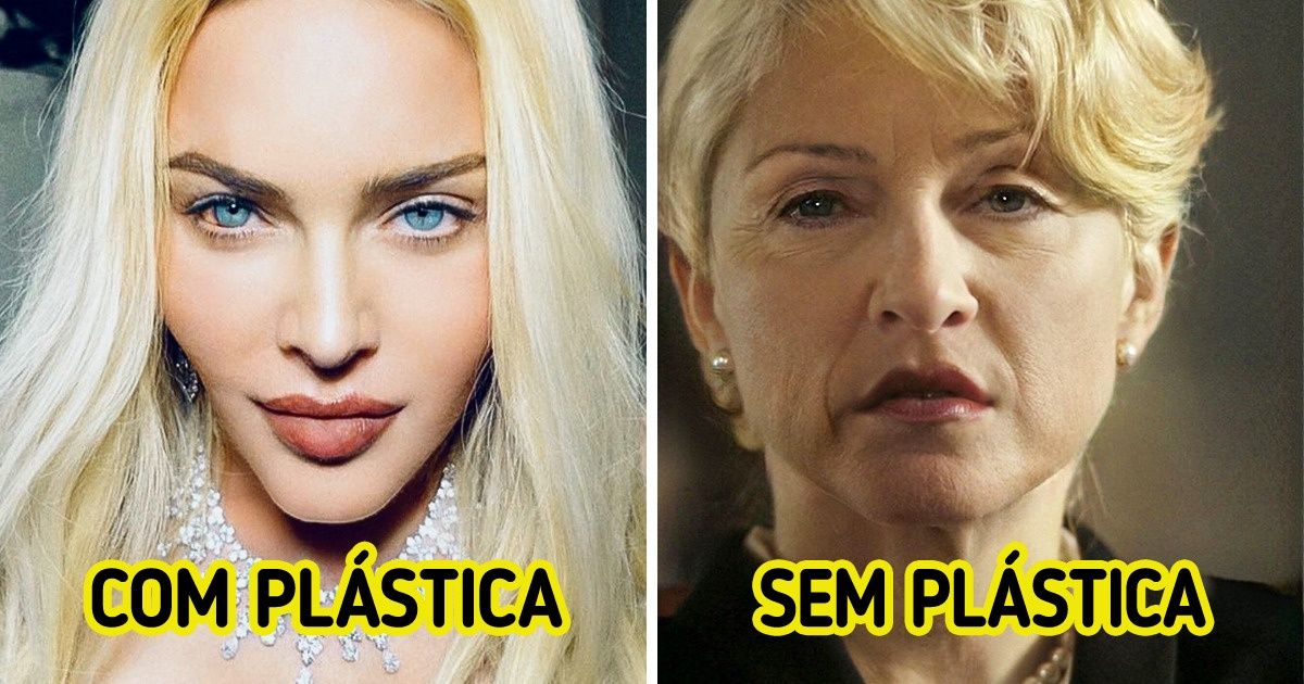 Como 9 famosos seriam, caso tivessem optado por envelhecer naturalmente Como 9 famosos seriam, caso tivessem optado por envelhecer naturalmente