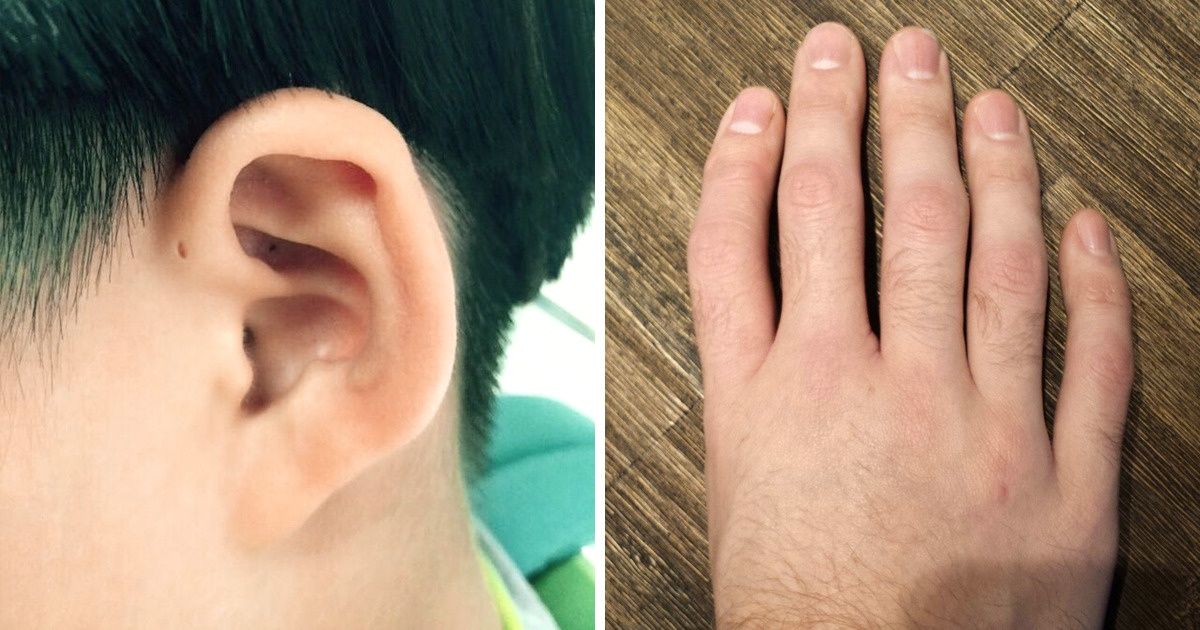 14 Pessoas que provam que a natureza é capaz de qualquer coisa