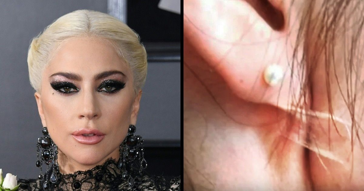 14 Procedimentos cosméticos pouco comuns utilizados por celebridades