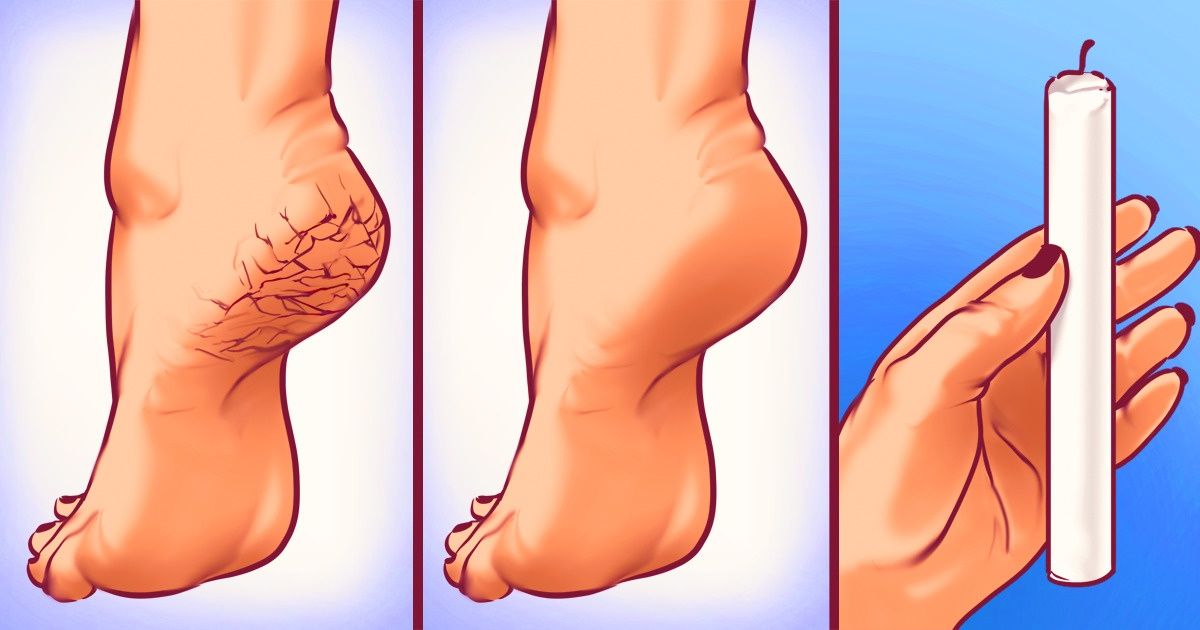 9 Utilidades pouco comuns para a cera ou a parafina 9 Utilidades pouco comuns para a cera ou a parafina