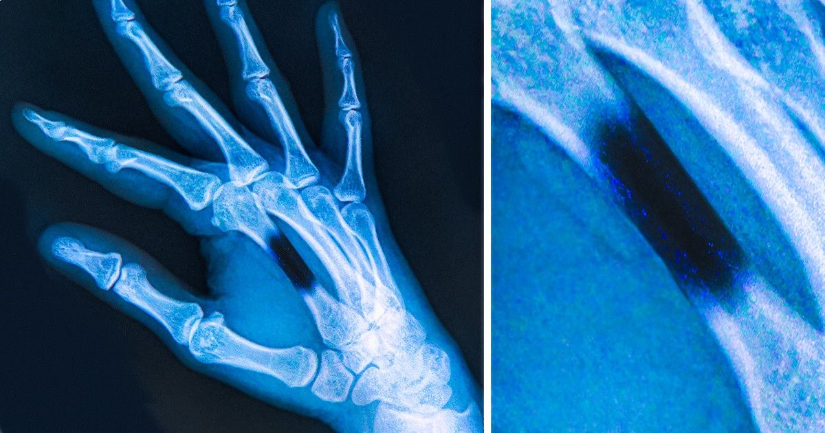 Efeitos terríveis causados por picadas ou mordidas de animais