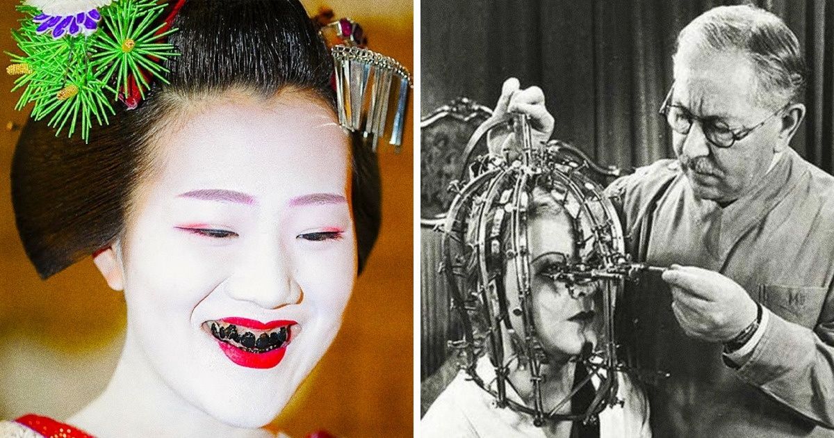 15+ Loucuras que as mulheres fizeram pela beleza no passado (e ainda fazem nos dias de hoje) 15+ Loucuras que as mulheres fizeram pela beleza no passado (e ainda fazem nos dias de hoje)