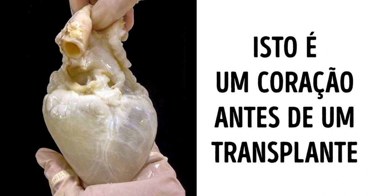 20 Fotos de coisas que você nunca viu, mas tinha curiosidade