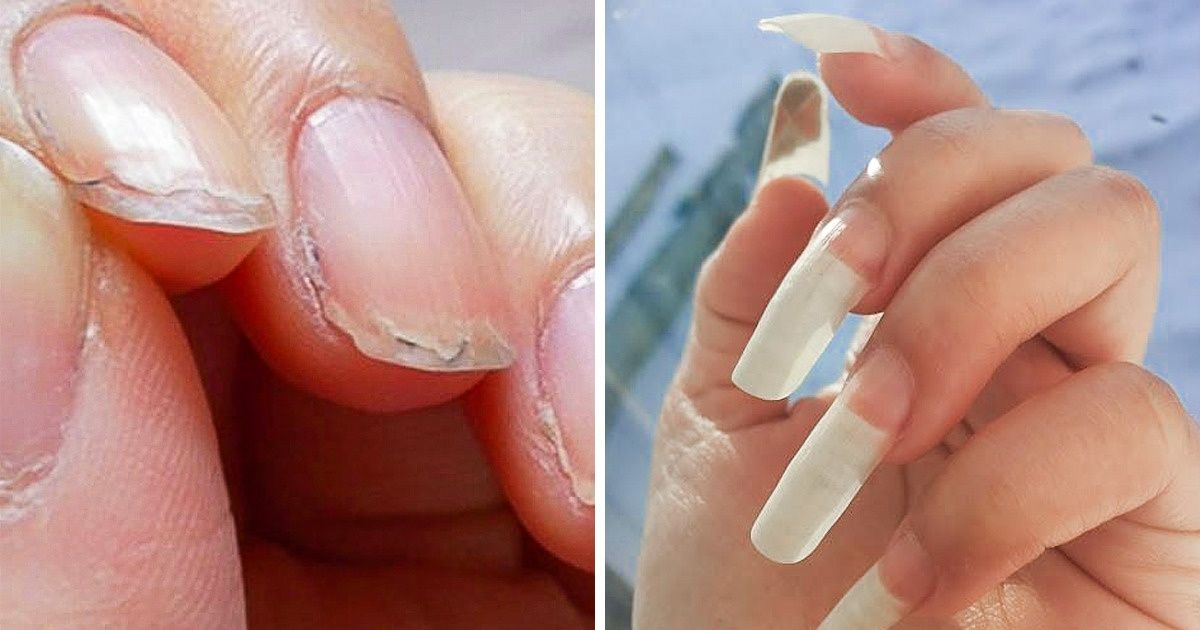 10 Dicas naturais para recuperar unhas frágeis e quebradiças 10 Dicas naturais para recuperar unhas frágeis e quebradiças
