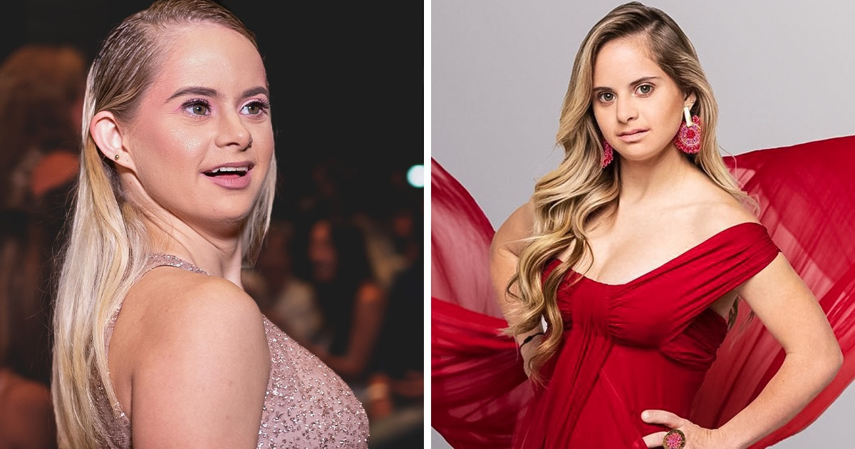 Uma garota com síndrome de Down segue carreira de modelo e prova como a inclusão é linda