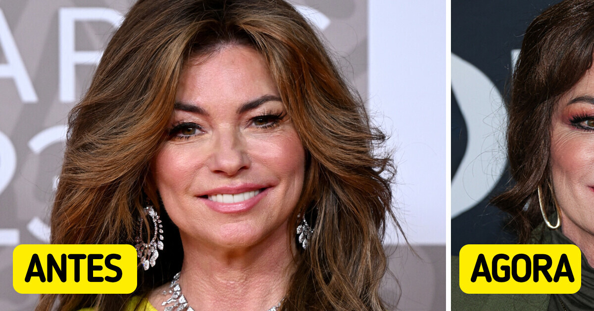 “O que ela fez no rosto?” — O novo visual de Shania Twain deixa muita gente chocada “O que ela fez no rosto?” — O novo visual de Shania Twain deixa muita gente chocada