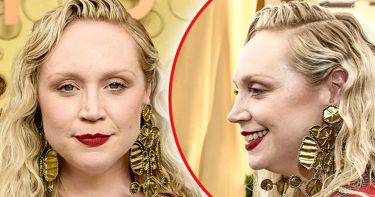 15+ Famosos que sempre posaram de frente, mas de lado são outra história 15+ Famosos que sempre posaram de frente, mas de lado são outra história