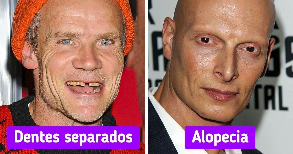 19 Famosos com atributos físicos que os tornam únicos, apesar de não fazerem parte do padrão de beleza convencional 19 Famosos com atributos físicos que os tornam únicos, apesar de não fazerem parte do padrão de beleza convencional