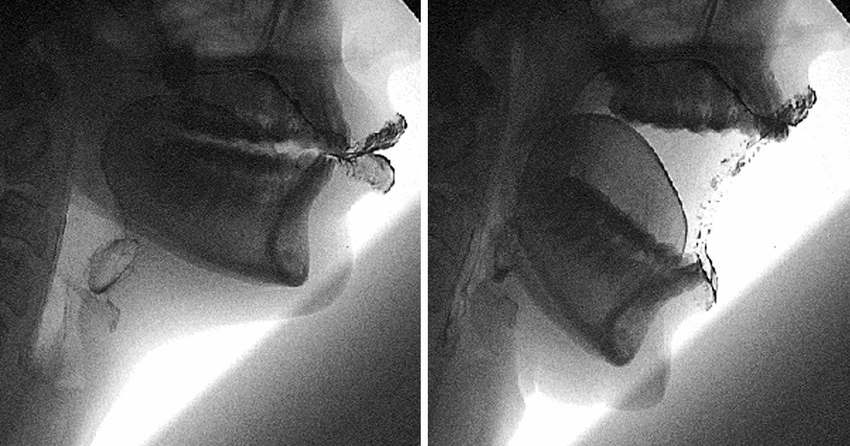 8 Coisas incríveis do nosso corpo que fazem dele o sistema melhor pensado do mundo