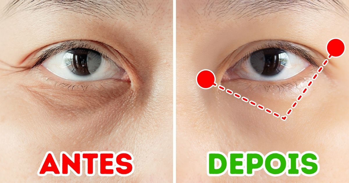 Um exercício japonês de 1 minuto que pode ajudar a eliminar as rugas ao redor dos olhos Um exercício japonês de 1 minuto que pode ajudar a eliminar as rugas ao redor dos olhos