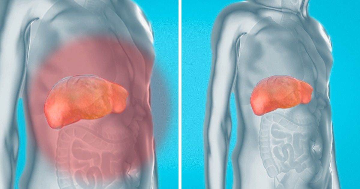 Como eliminar as toxinas dos rins, fígado e bexiga de forma natural