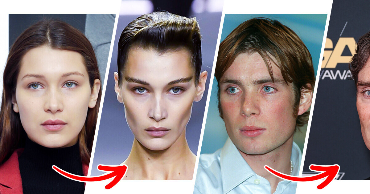 14 Famosos que redefiniram a própria face com novas maçãs do rosto 14 Famosos que redefiniram a própria face com novas maçãs do rosto