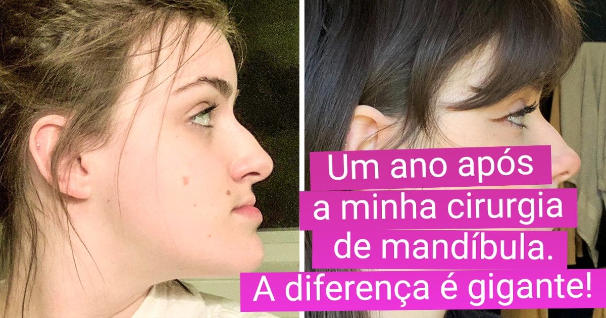 20+ Mulheres que disseram “sim” para as mudanças e se transformaram em novas pessoas 20+ Mulheres que disseram “sim” para as mudanças e se transformaram em novas pessoas