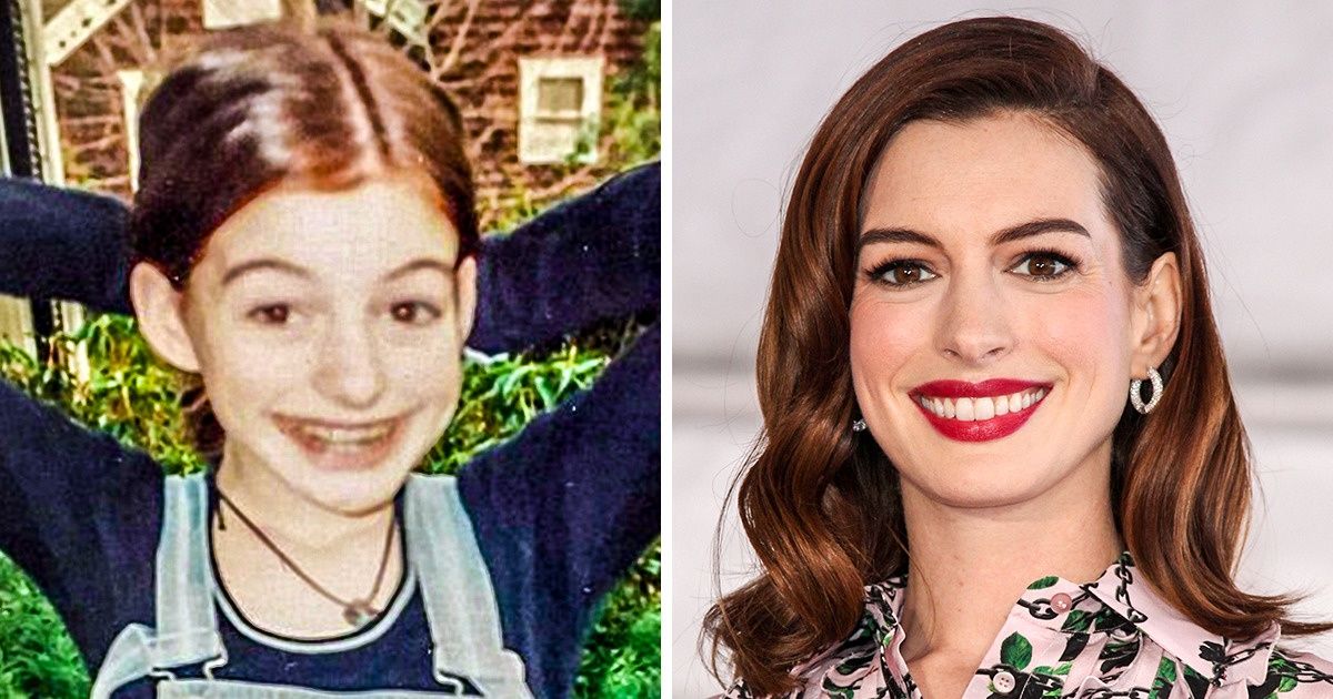 9 Atrizes famosas que se transformaram de “patinhos feios” em “belos cisnes” 9 Atrizes famosas que se transformaram de “patinhos feios” em “belos cisnes”