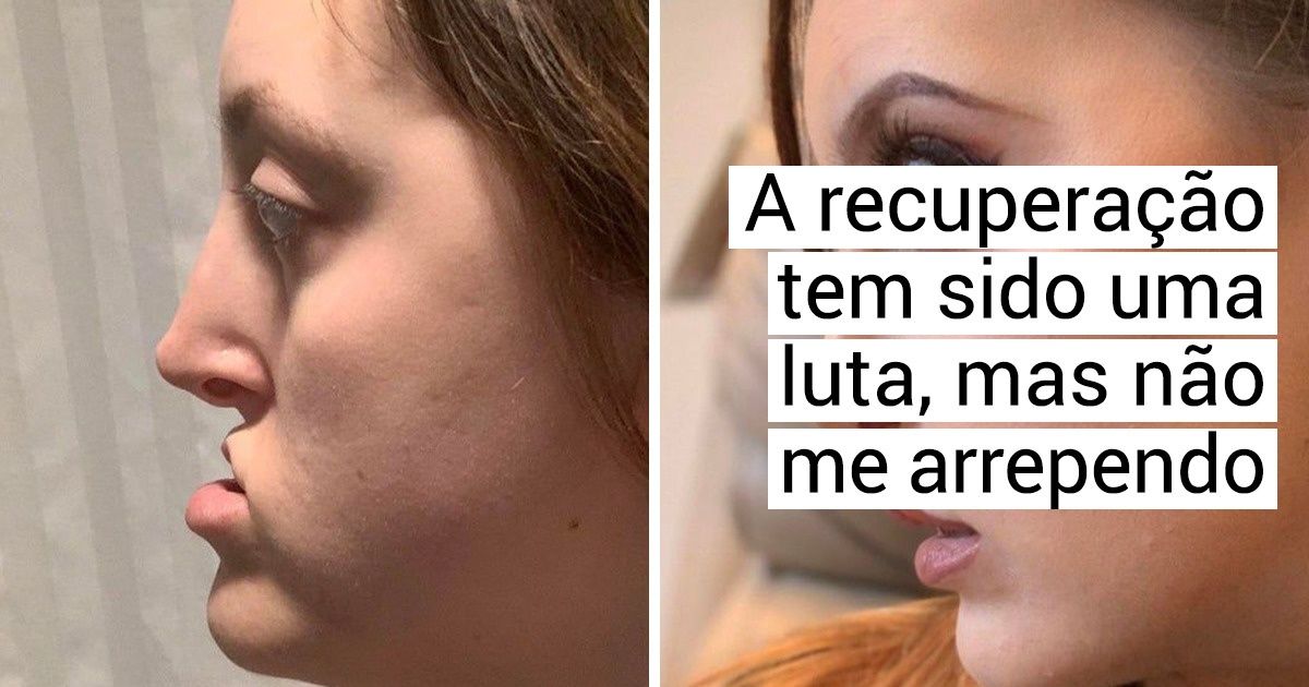 20 Pessoas que mudaram algo no rosto e ganharam uma aparência completamente diferente 20 Pessoas que mudaram algo no rosto e ganharam uma aparência completamente diferente