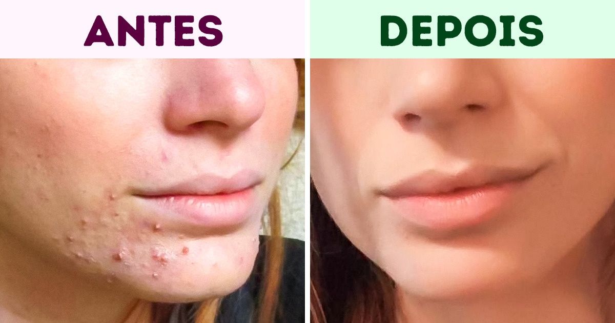 7 Dicas sensacionais e simples para cuidar da pele