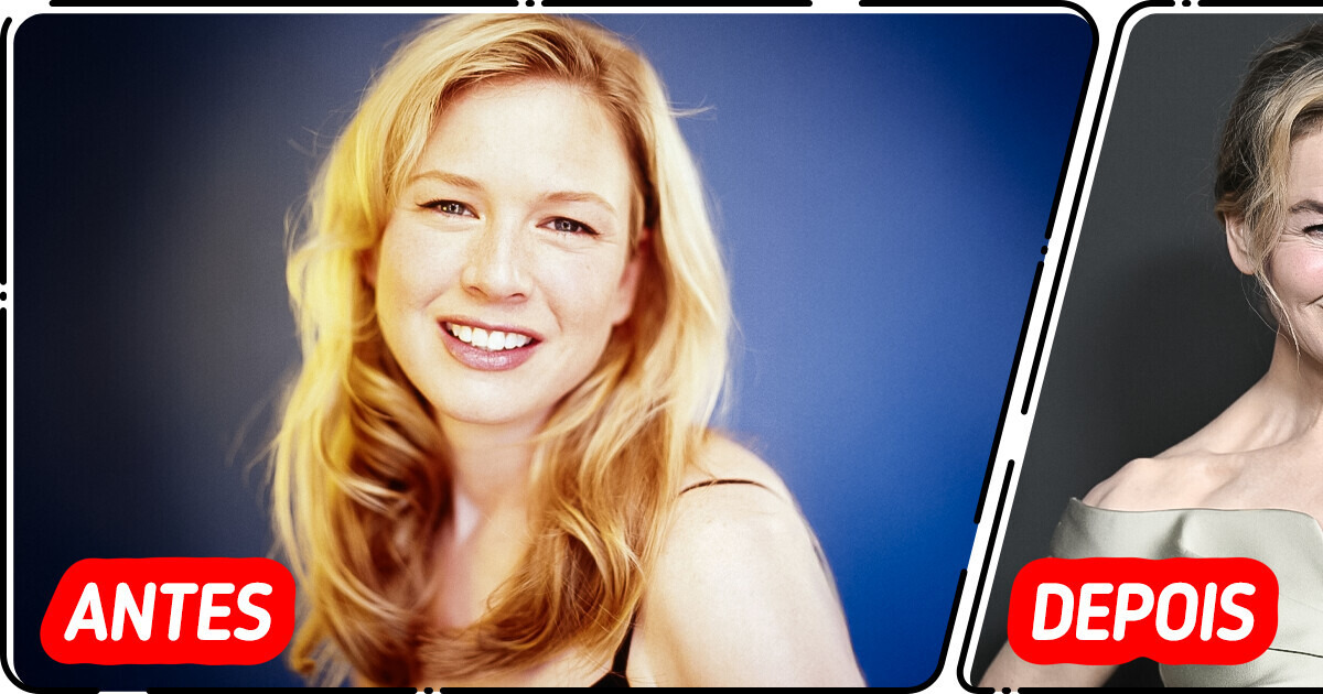 “O que há de errado com os lábios dela?” Novo visual de Renée Zellweger deixa os fãs preocupados