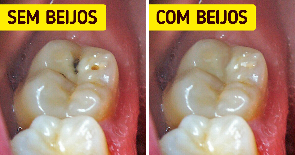 O que pode acontecer com o seu corpo quando você beija alguém