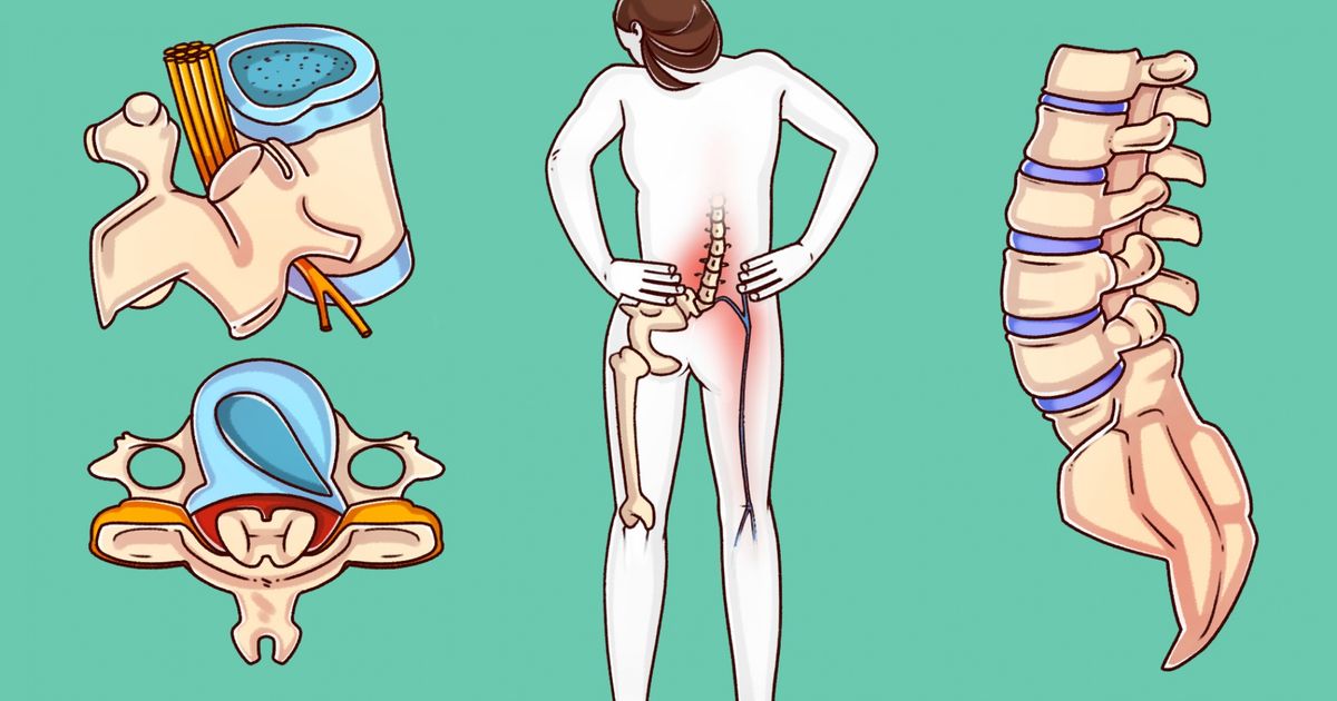 Cirurgião indica exercícios capazes de tratar sua coluna antes que seja tarde demais Cirurgião indica exercícios capazes de tratar sua coluna antes que seja tarde demais