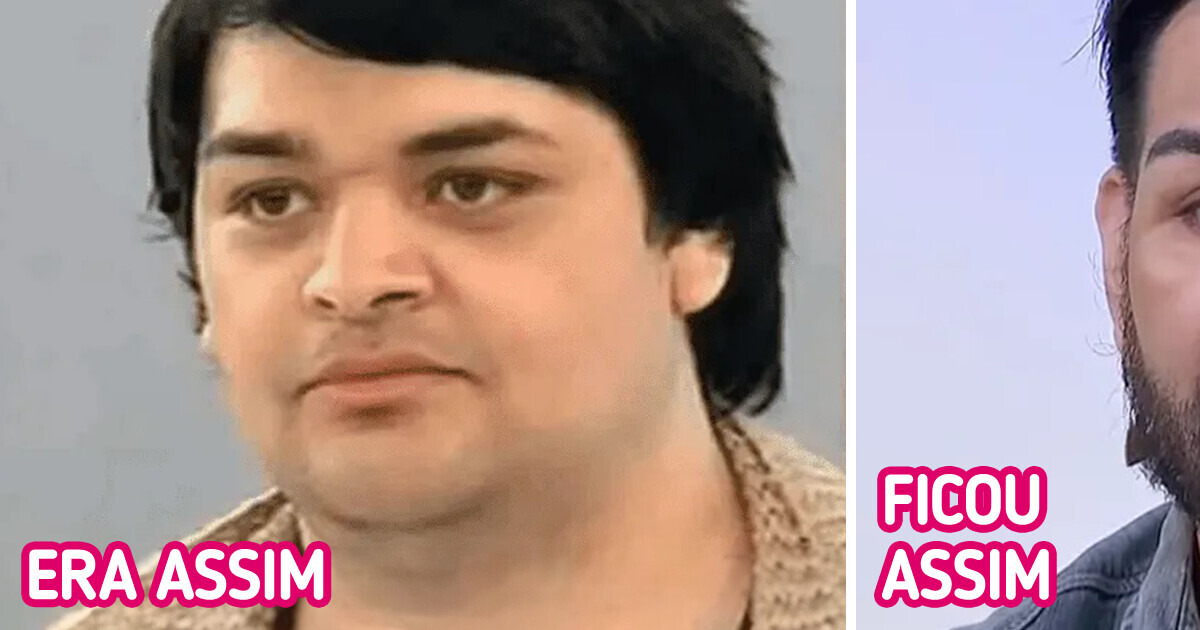 Homem fica desfigurado após passar por mais de 30 cirurgias para ficar parecido com o Ricky Martin