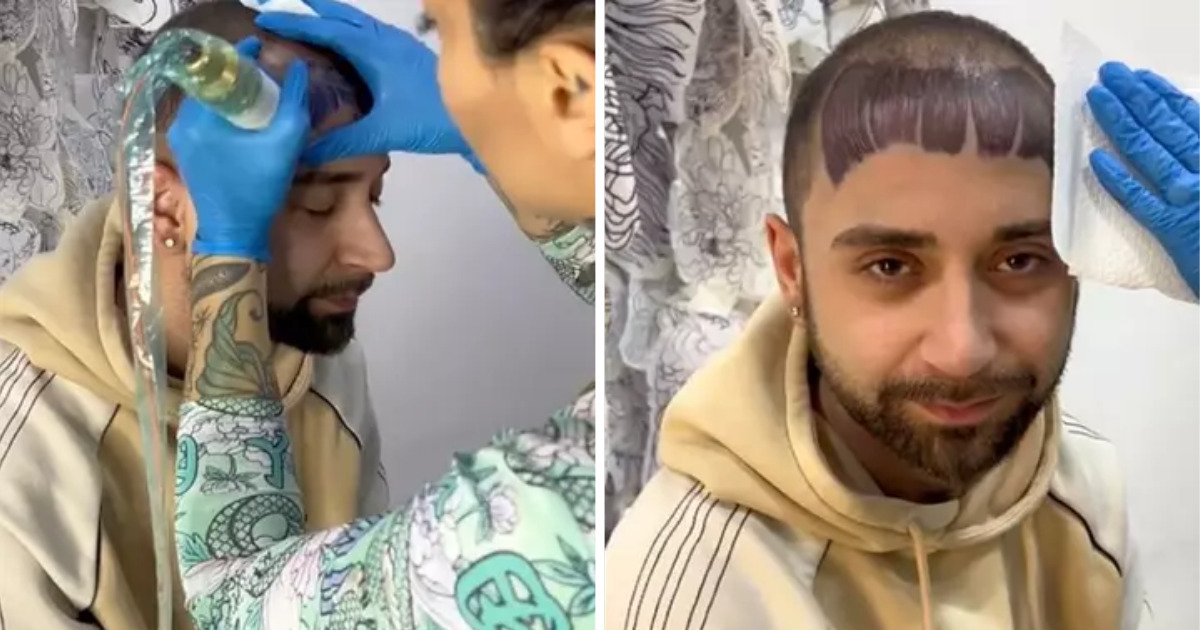 Inovação ou moda? Homem calvo decidiu tatuar uma franja na testa