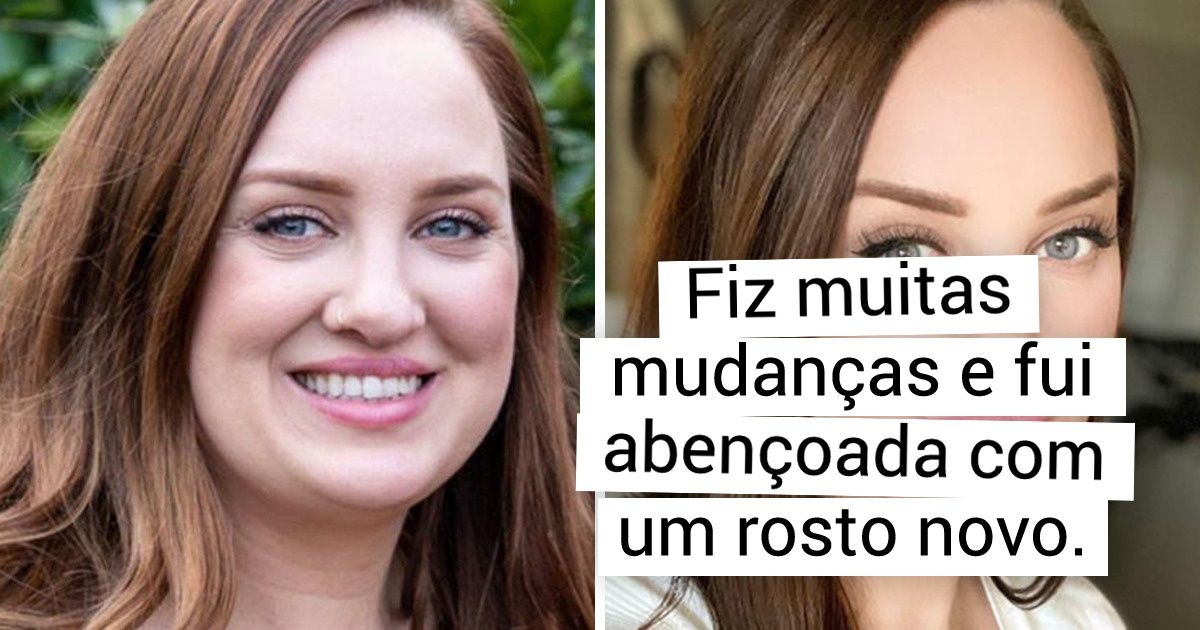20 Fotos de antes e depois que mostram que a hora de agir é agora