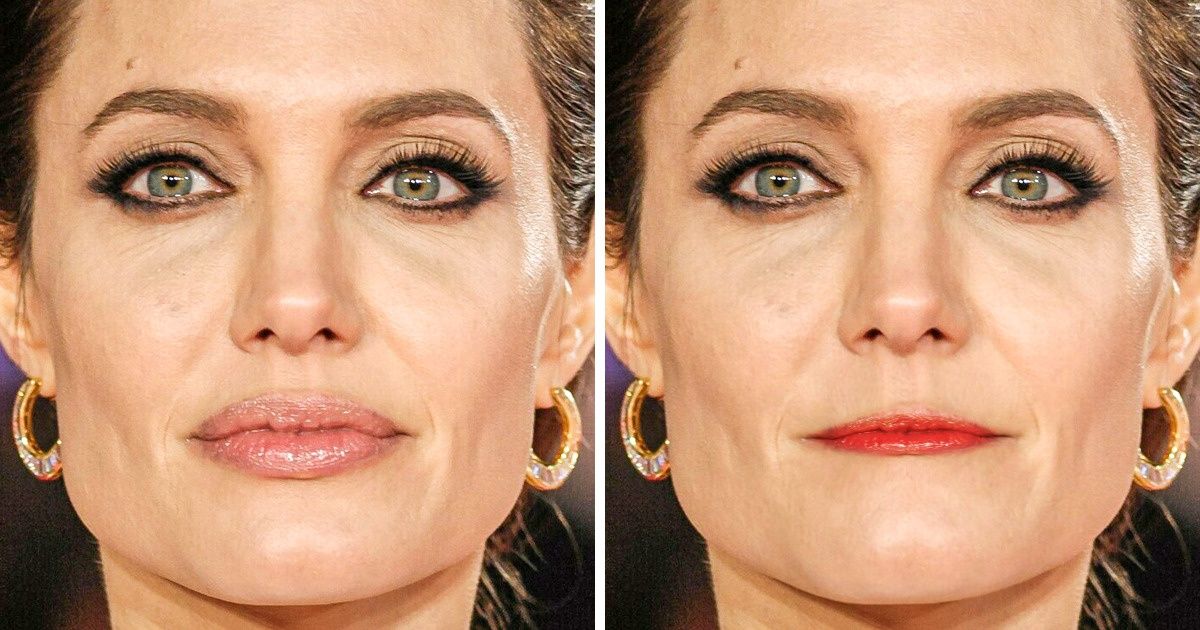 17 Fotos mostram como um ajuste nos lábios pode mudar totalmente o rosto 17 Fotos mostram como um ajuste nos lábios pode mudar totalmente o rosto
