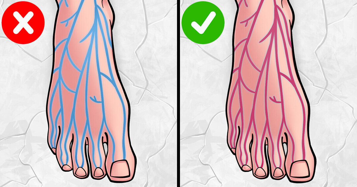 9 Sinais de alerta de deficiência de ferro que você pode estar ignorando